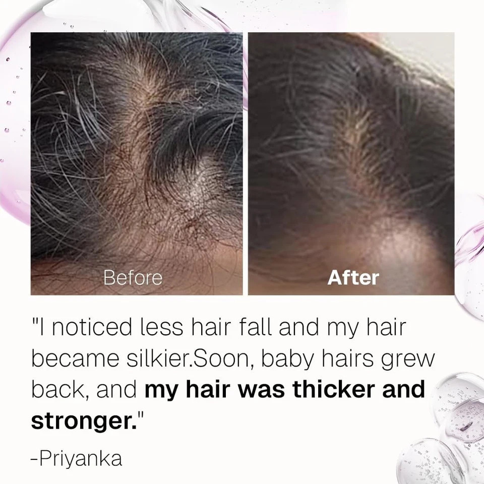 Bontress PRO+ Scalp Serum Dermat recommended Hair Growth in 28 Days 60ml