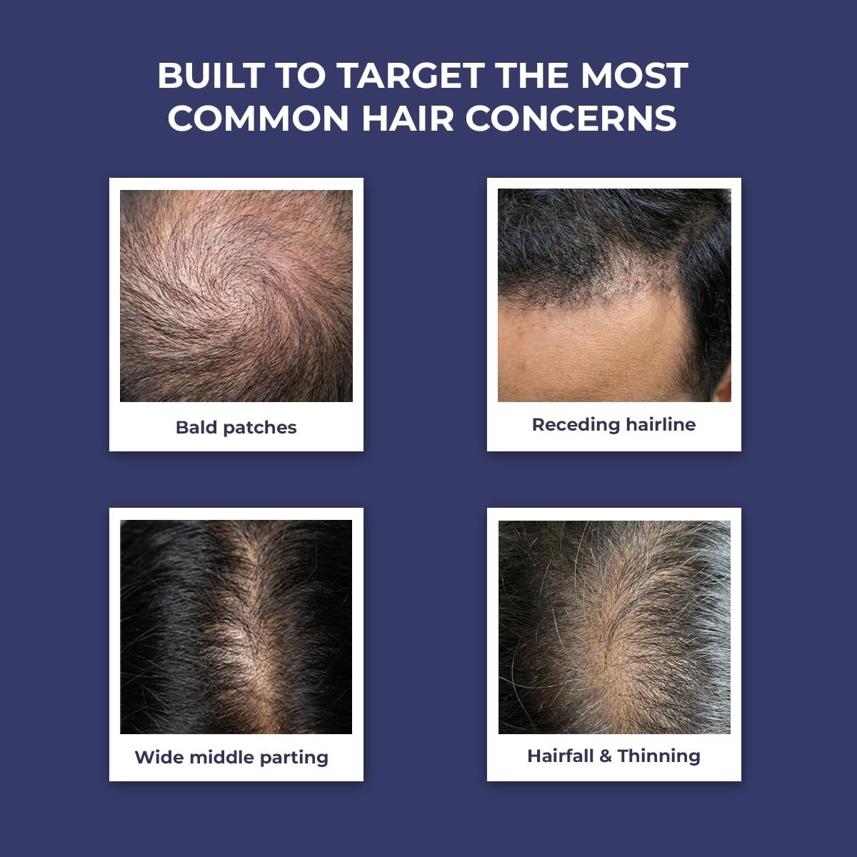 Conscious Chemist Anti Hairfall Shampoo For All Hair Types Women & Men 200ml