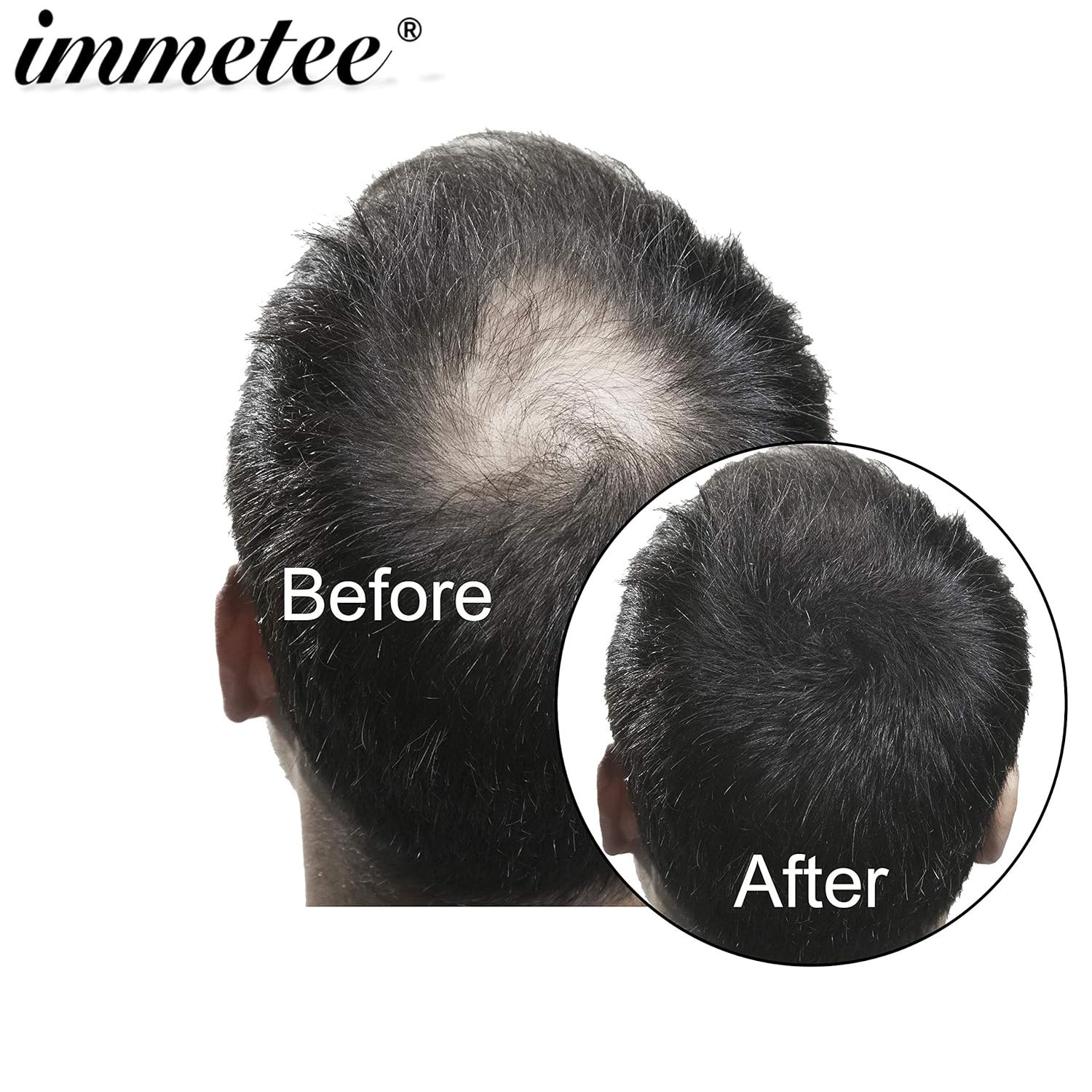 immetee Hair Building Fibers Powder Hair Fibres 2 Bottles Medium Brown 28g
