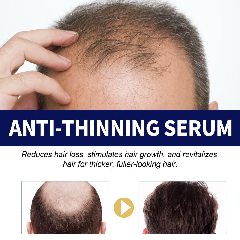 Hair Repair Liquid Moisturizing and Nutritious Hair Scalp Deep