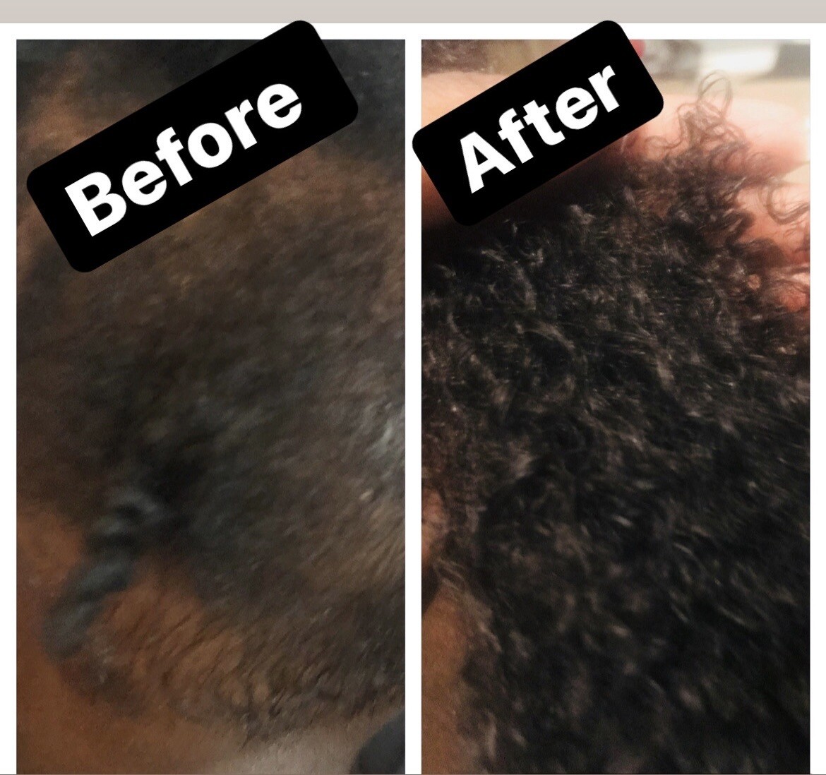 ORGANIC Children/ Baby hair Growth oil-Cradle cap, Scalp eczema, Hair Growth Oil