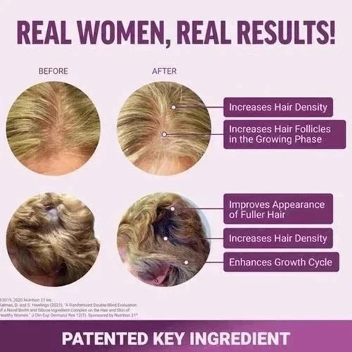 Hair Growth Soft Chews Thicker Stronger Hair 60 Mixed Berry Reduce Wrinkles