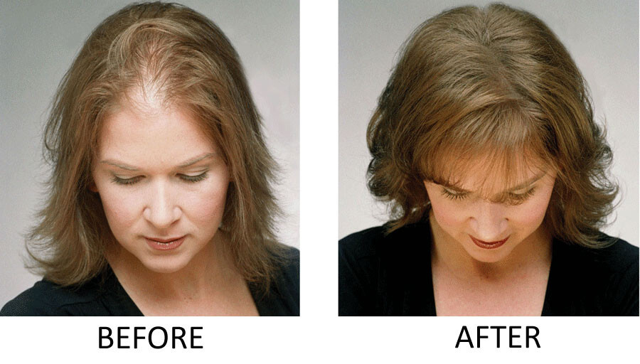 10x Hair So Real 28g – Hair Thickening Building Keratin Fibers – HSR HairSoReal
