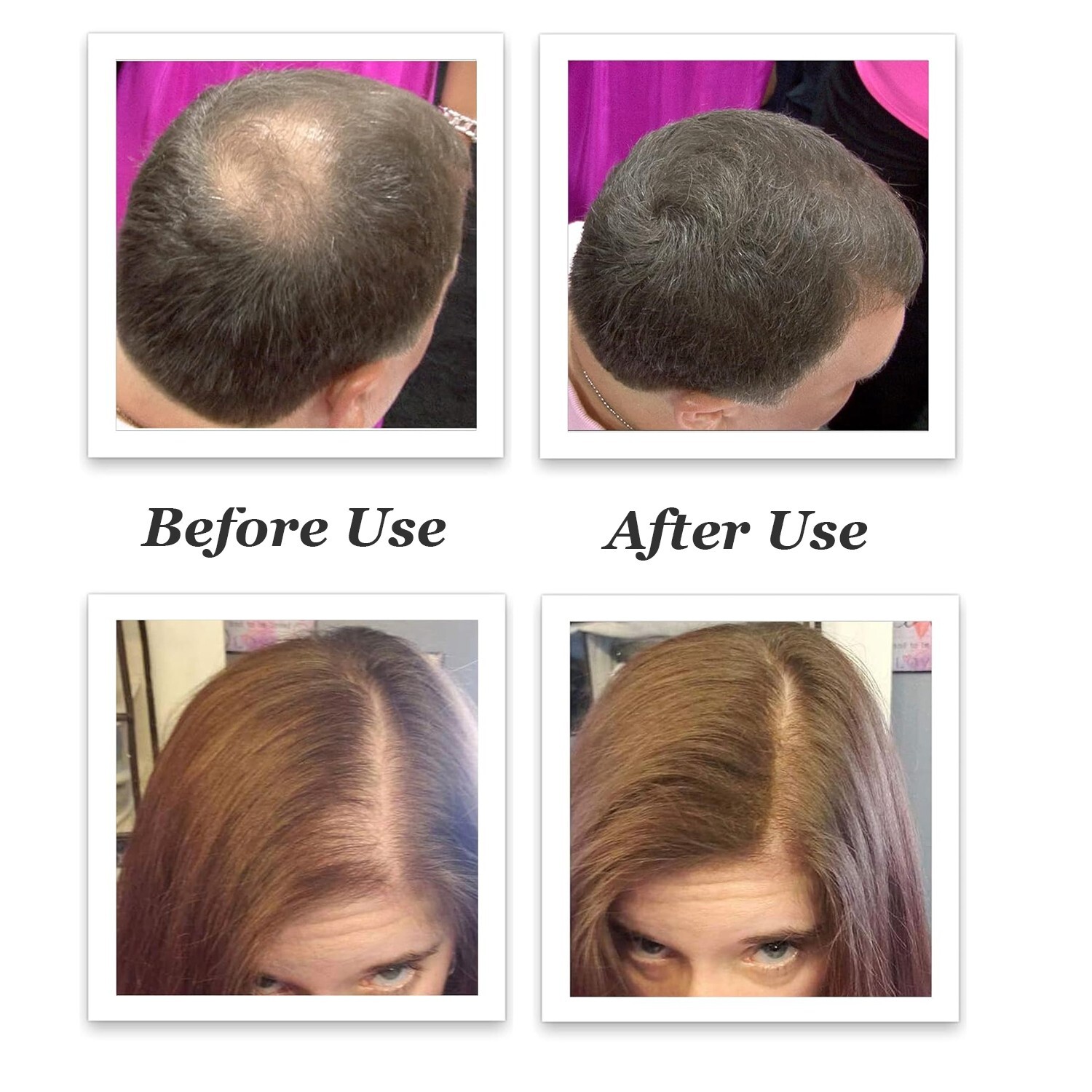 VIKADA Hair Fibers Hair Thickening Fibers Keratin Powder Hair Building 27.5g