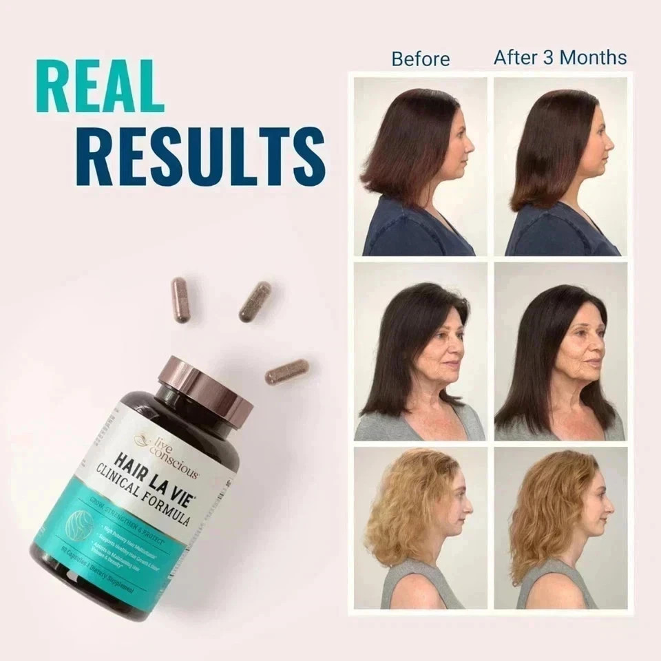 Pack of 2 Hair La Vie Clinical Formula Hair Growth Vitamins for Women & Men 2027
