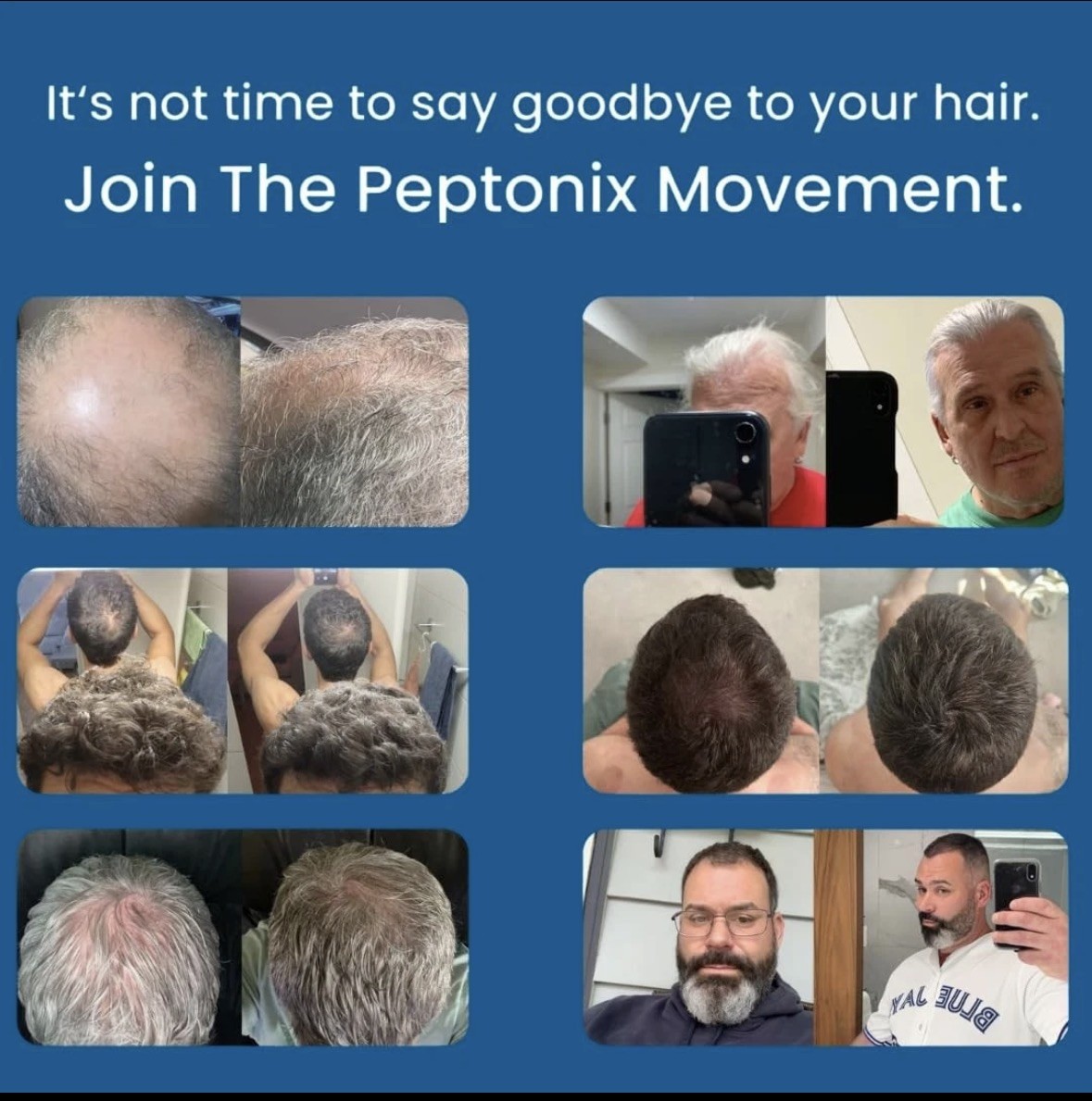 Peptonix Copper Peptide Infusion Hair Growth System-3 months worth! Exp 6/2029