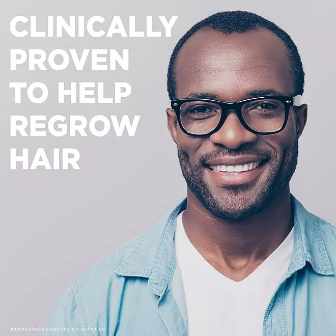 Kirkland Minoxidil 5% Extra Strength Men 6 Month EXP: 03/25 Hair Growth Solution