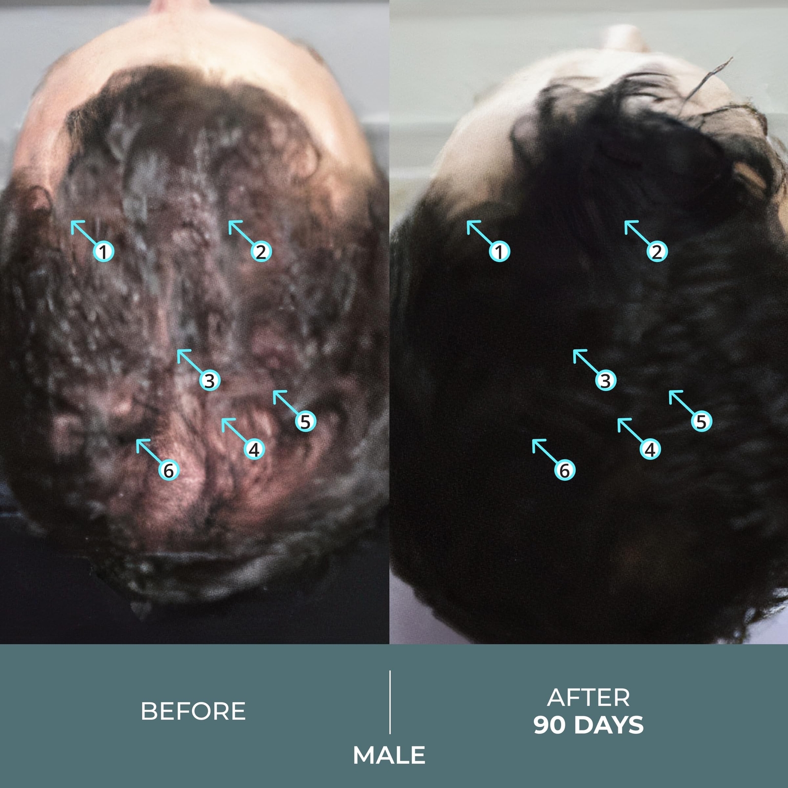 DS Laboratories Spectral.DNC-N & Spectral.F7 Hair Serum – Hair Regrowth Treat…