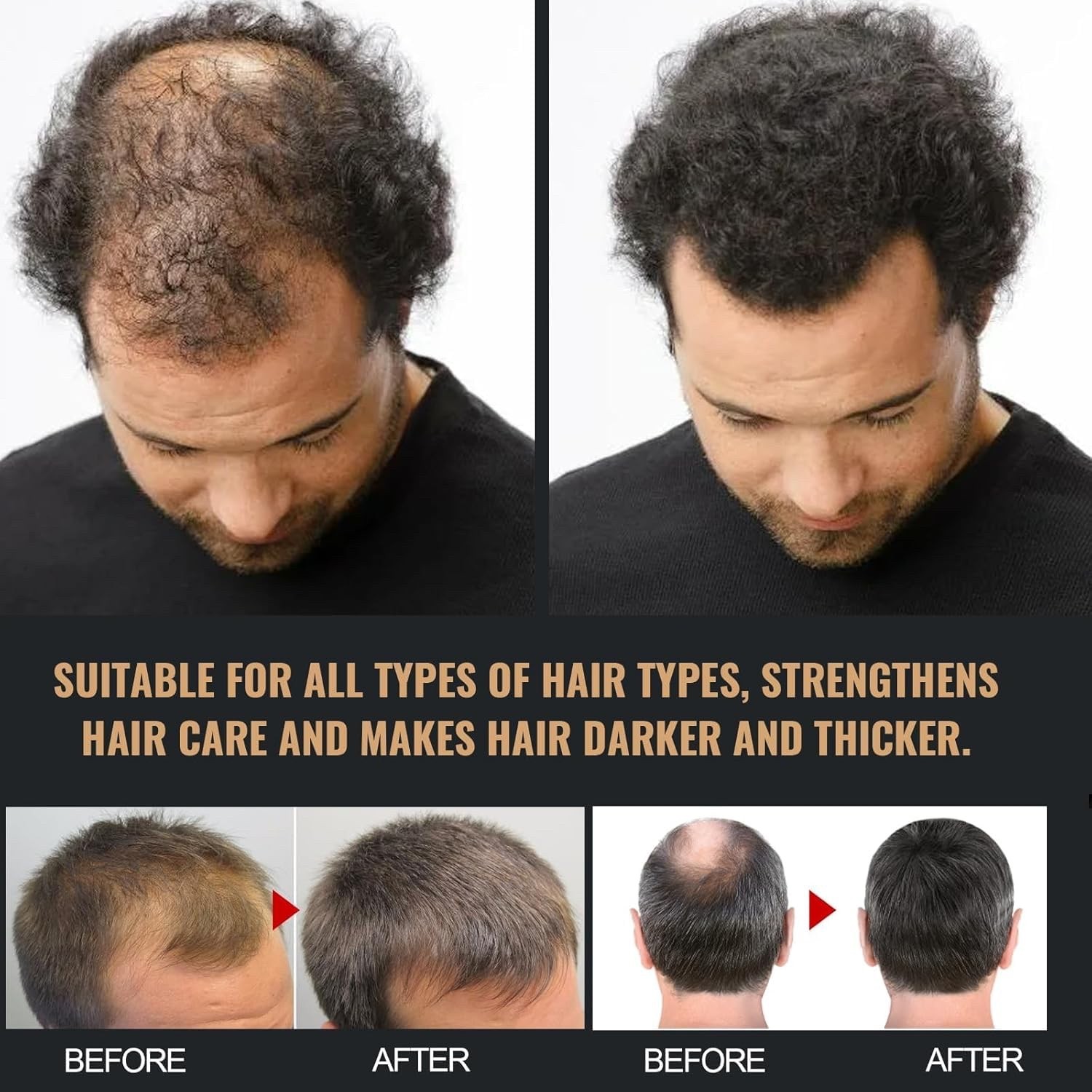 Root Activator Shampoo,Hair Regrowth, Unisex, Natural Formula for Men and Women,