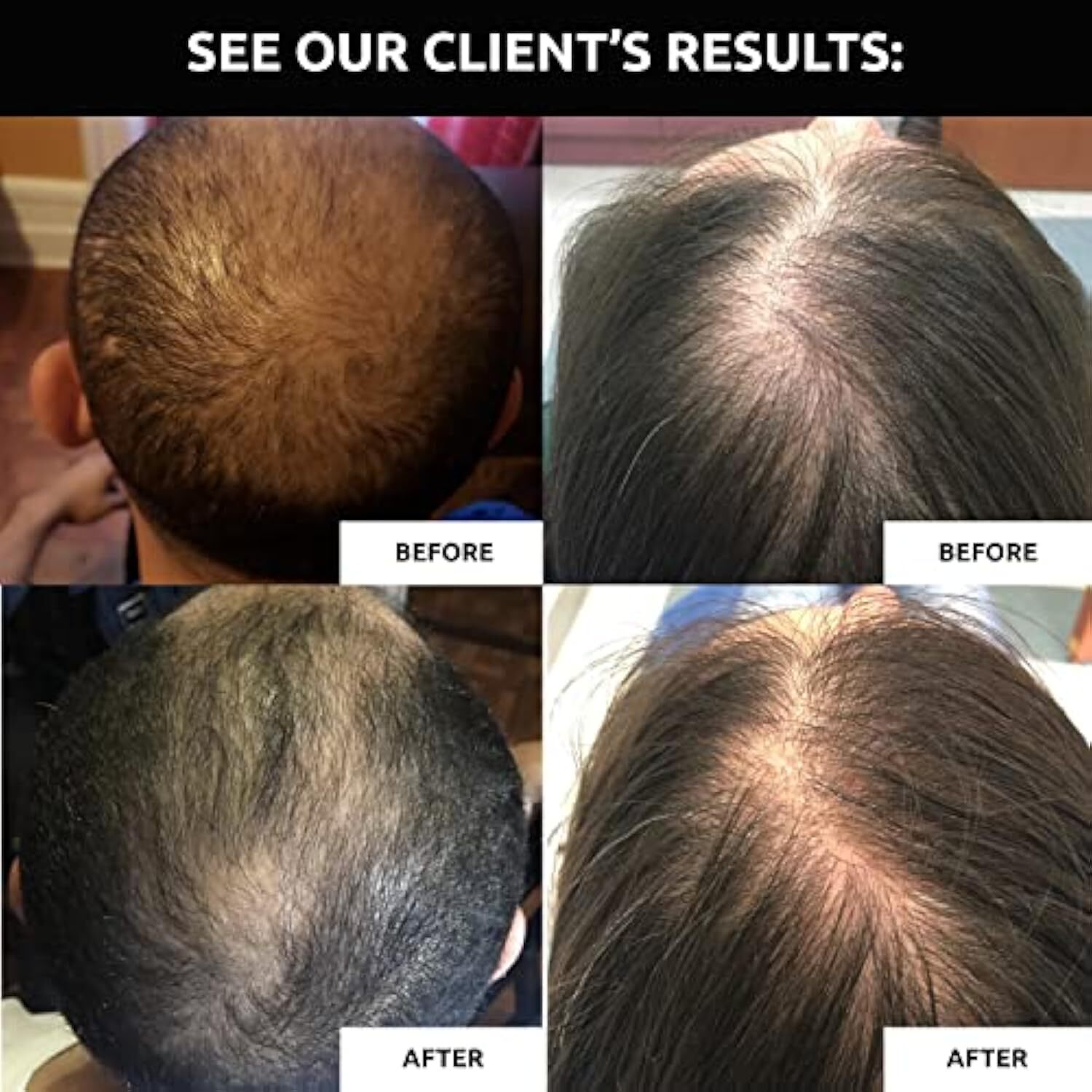 Revita Hair Growth Shampoo For Thinning Hair and Hair Loss by DS Laboratories,