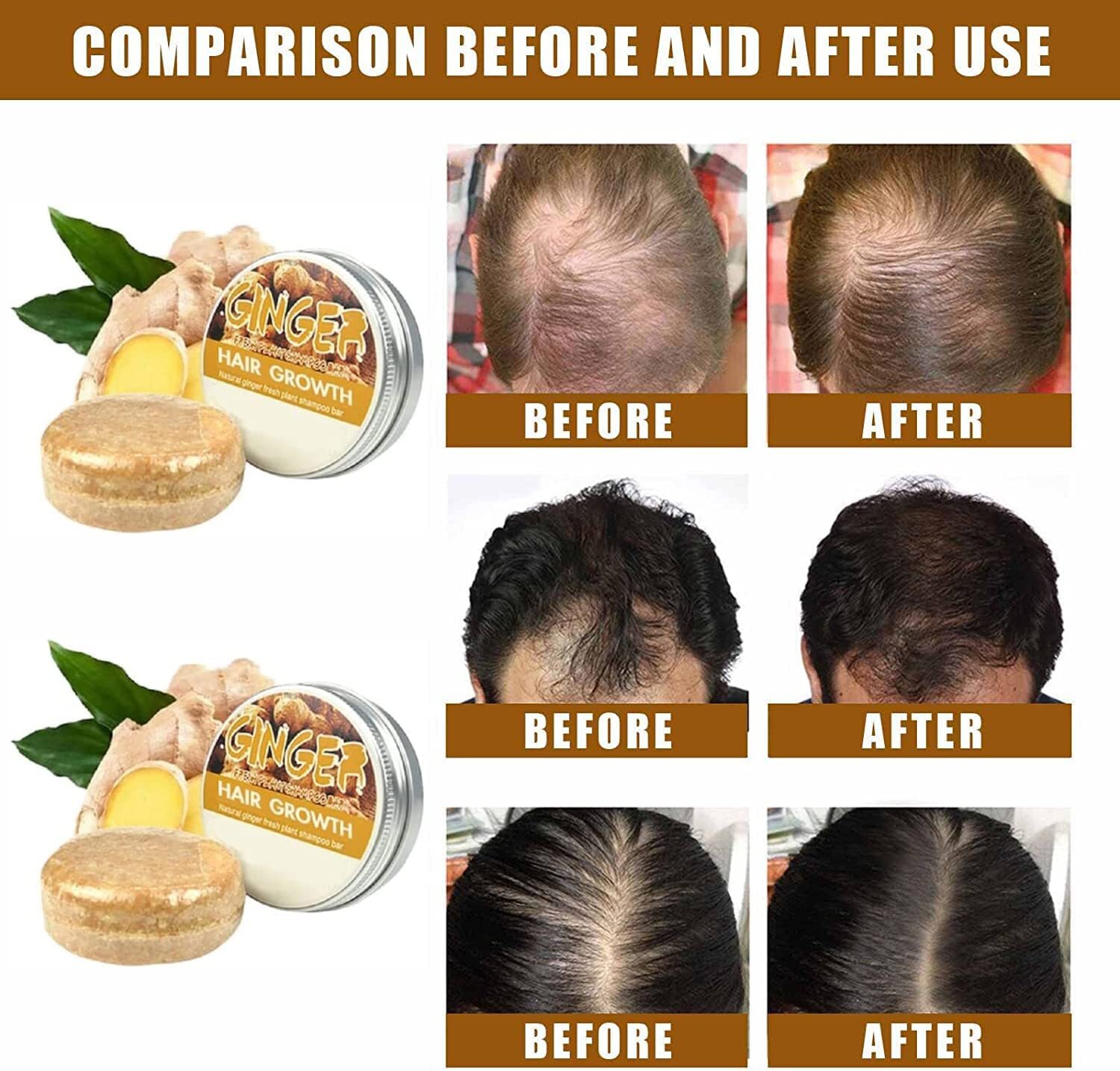 3PCS Ginger Hair Regrowth Shampoo Bar Hair Growth Soap Hair Loss Treatment USA