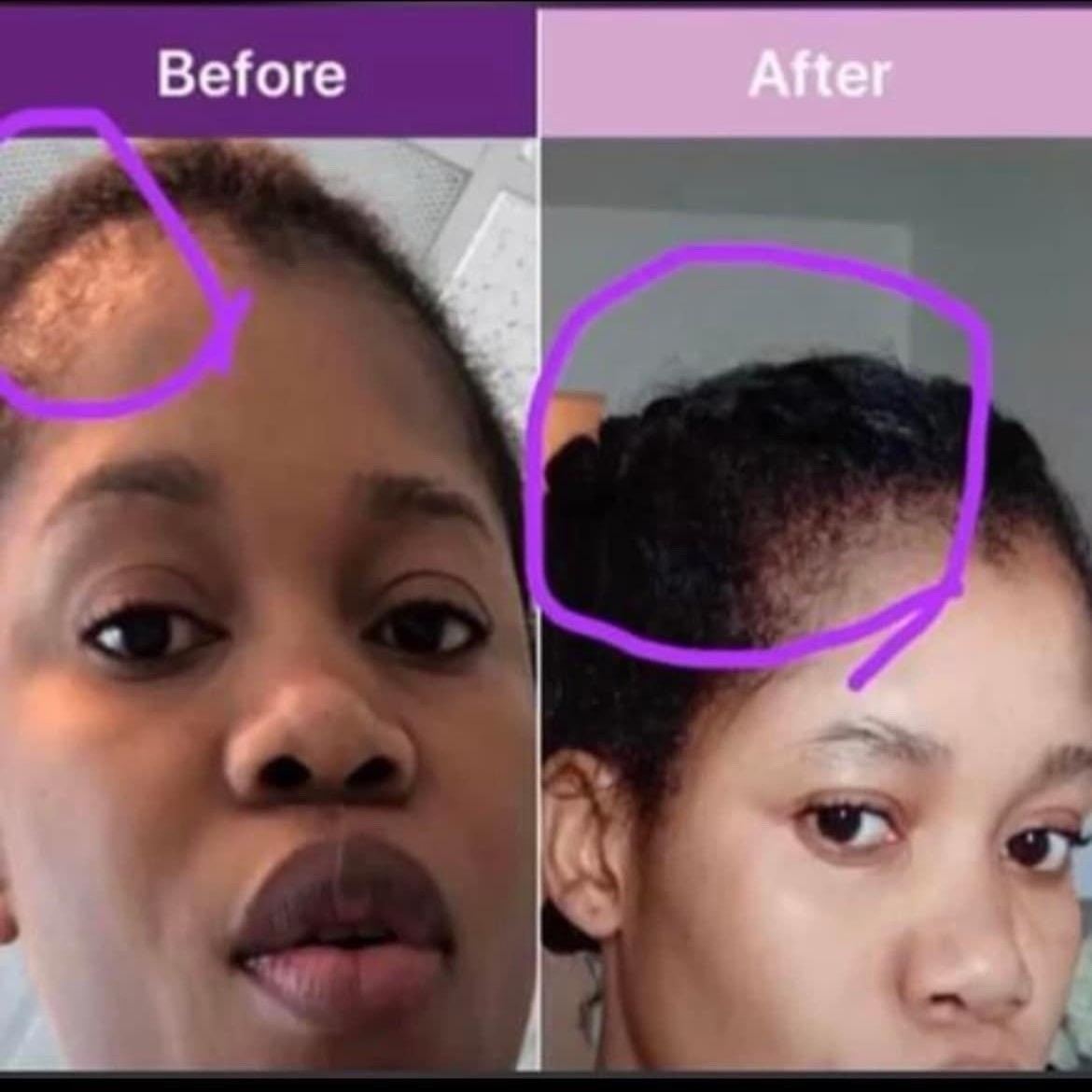 POWERFUL HAIR GROWTH OIL 4oz 100% NATURAL INGREDIENTS FOR ANY TYPE OF HAIR