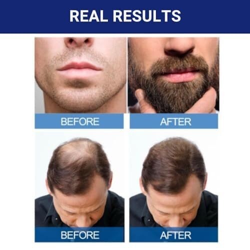 Kirkland Minoxidil 5% Extra Strength Men 6 Month EXP: 03/25 Hair Growth Solution