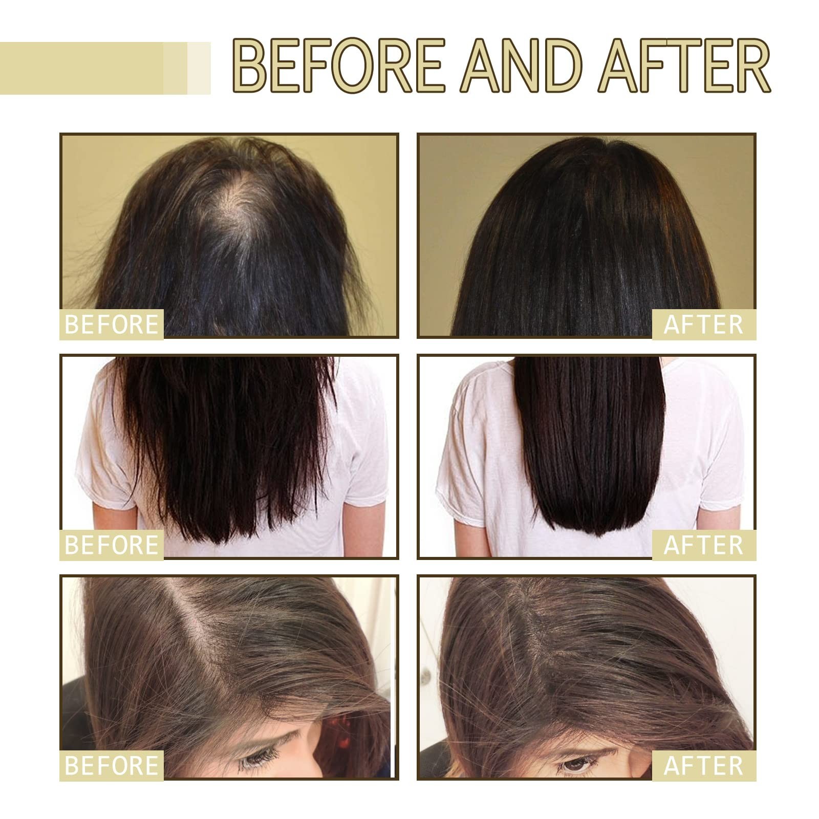 Natural Hair Growth Oil for Dry, Damaged & Thin Hair – Nourishing Unisex Formula