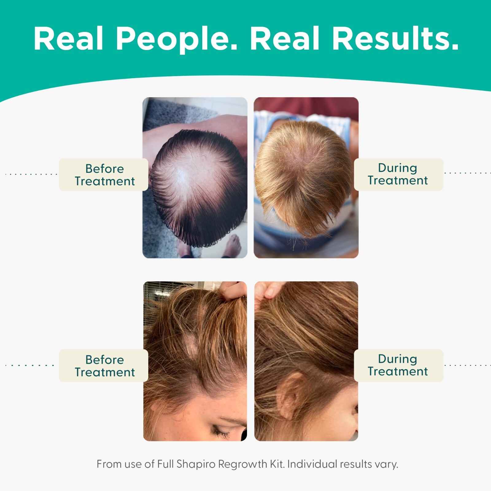 Hair Loss Leave-in Conditioner, Natural Vegan, DHT Blockers for Thinning Hair