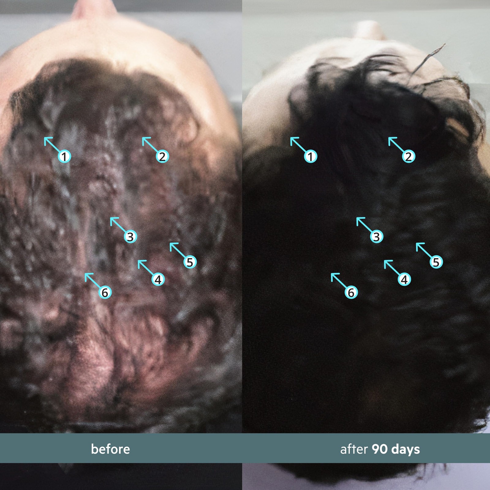 DS Labs Spectral Booster (formerly Spectral.F7) Hair Density Serum, 60mL – No…
