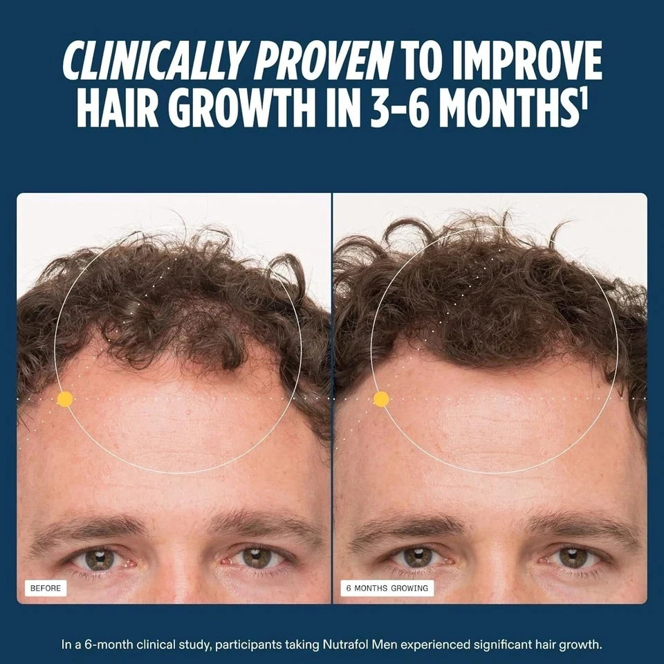 Packof 3 Men’s Hair Growth Total 360 Caps Exp 06/2027 Fast Shipping