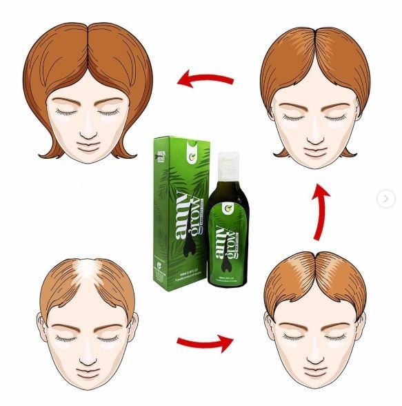 AmyGrow Hair Oil Hair growth Reduce Hair Fall Reduce premature grey -1 qty