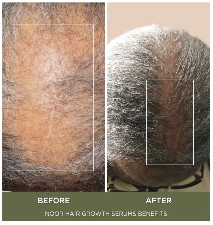 NOOR Super Hair Serum 2fl oz Hair Growth Liquid with Natural Ingredients