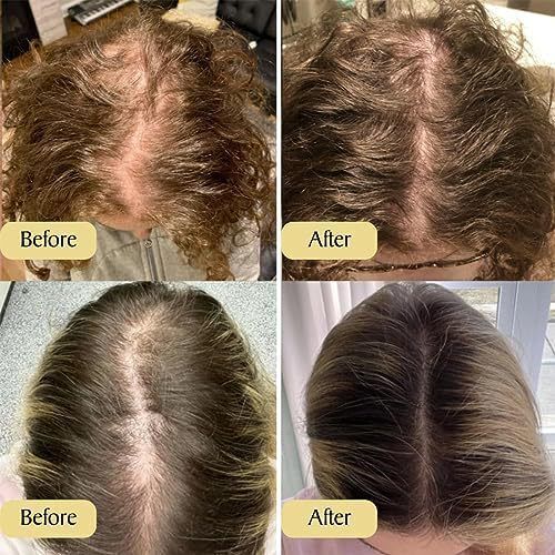Moisturizing Essential Oil for Soft Hair Care – Repair Formula for Men & Women