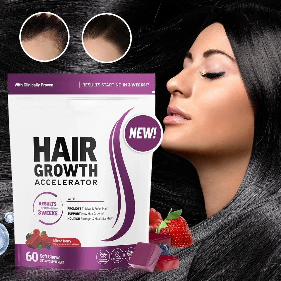 Force Factor Hair Growth Gummies – Supports hair growth and nourishes hair