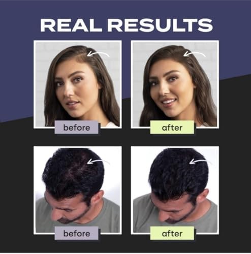 Toppik Hair Building Fiber Natural Black Pack of 2 x 27.7 Gram Free ship