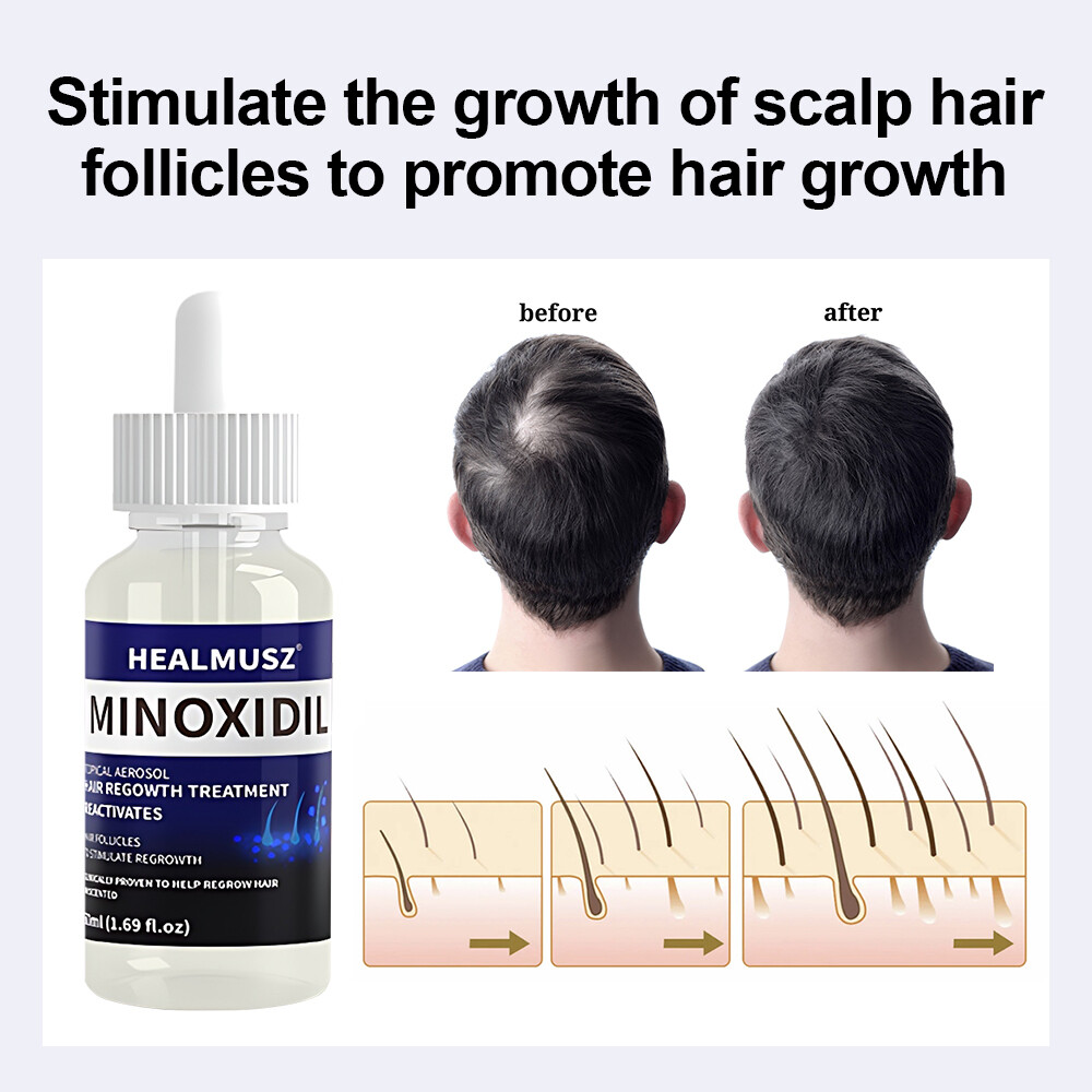 HEALMUSZ Minoxidil 5% Topical Solution Hair Regrowth, Reactivates Hair Follicles