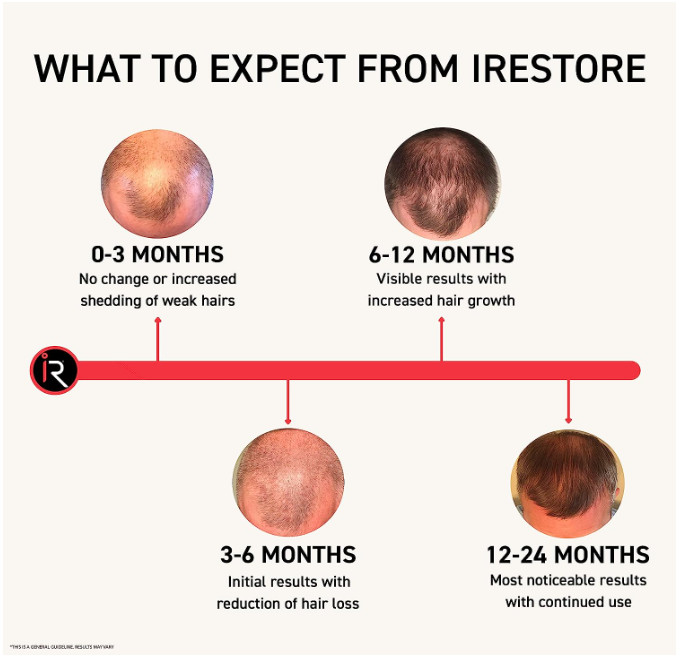 iRESTORE Professional 282 Laser Hair Growth System – Reconditioned