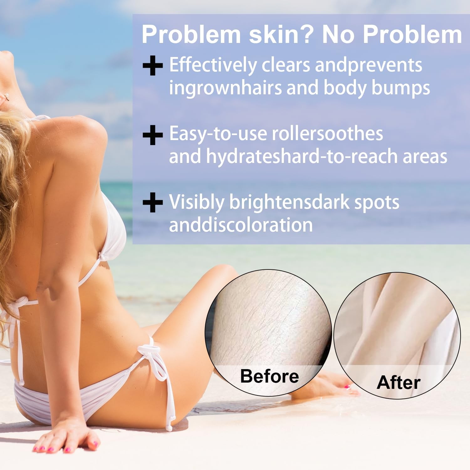 Smoothing Solution Ingrown Hair Treatment Serum for Razor Bumps and Bikini Li…