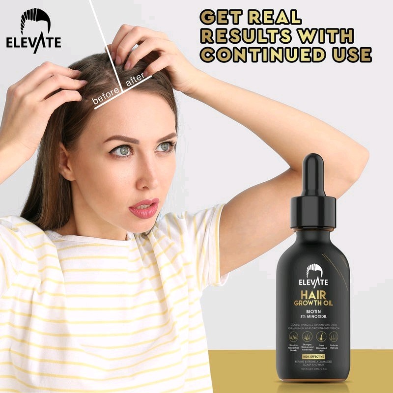 2-Pack, Elevate Hair Growth Oil Biotin 5% Minoxidil 1oz Scalp & Hair Repair, New