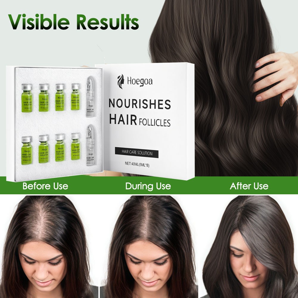 Hair Regrowth System,Advanced Alpha Infuse Microneedle Hair Regrowth Treatment