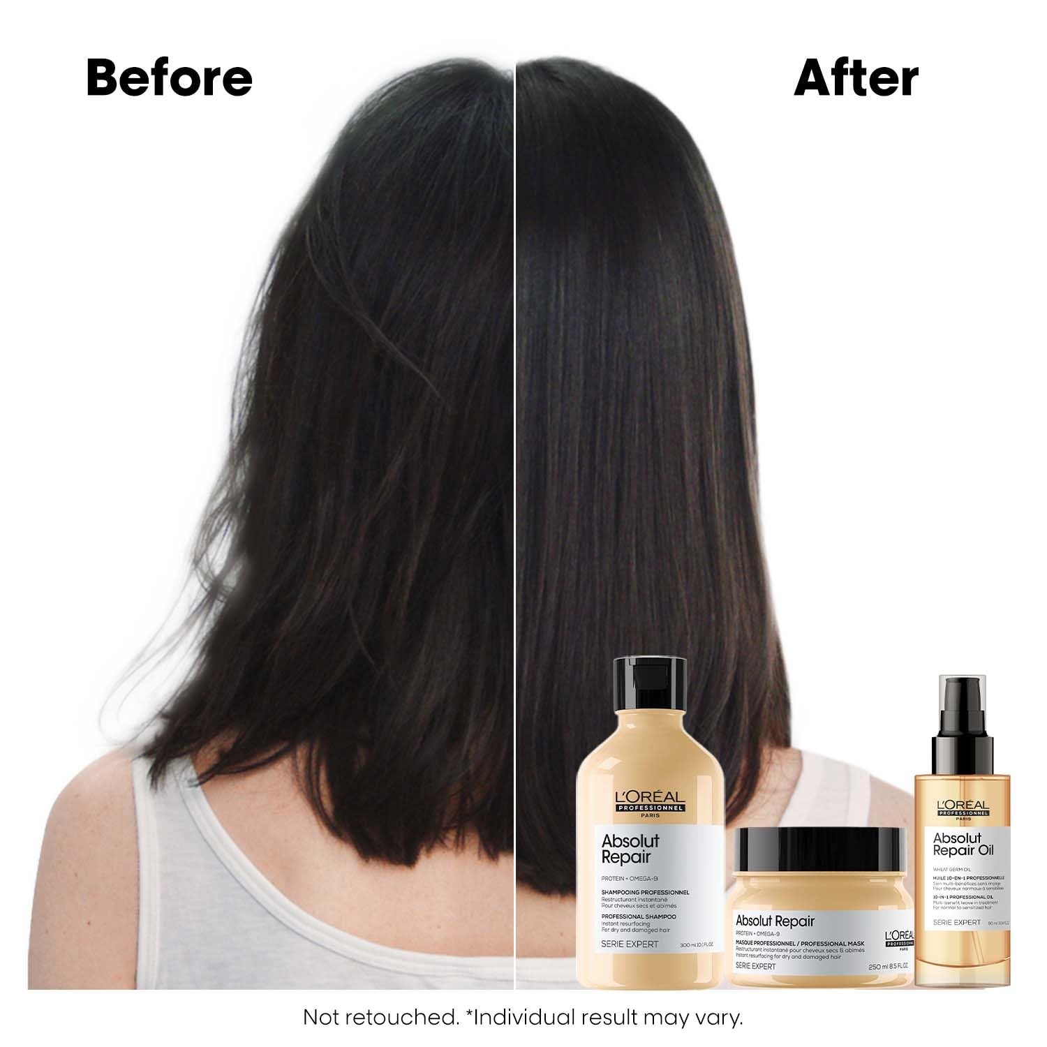 L’Oréal Serie Expert Shampoo 300ml, Hair Mask 250ml & Hair Serum 90ml | Combo