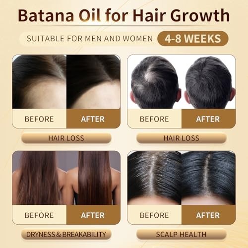 Batana Oil for Hair Growth, 100% Pure & Organic, Traditional Palm Nut | Cold Pre
