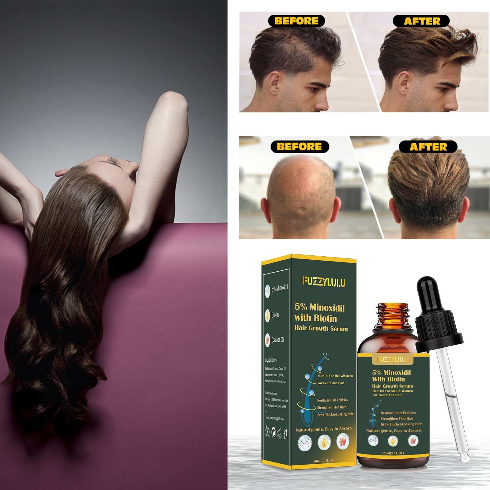5% Minoxidil Biotin Hair Growth Serum for Healthier and Thicker Hair, 60mL