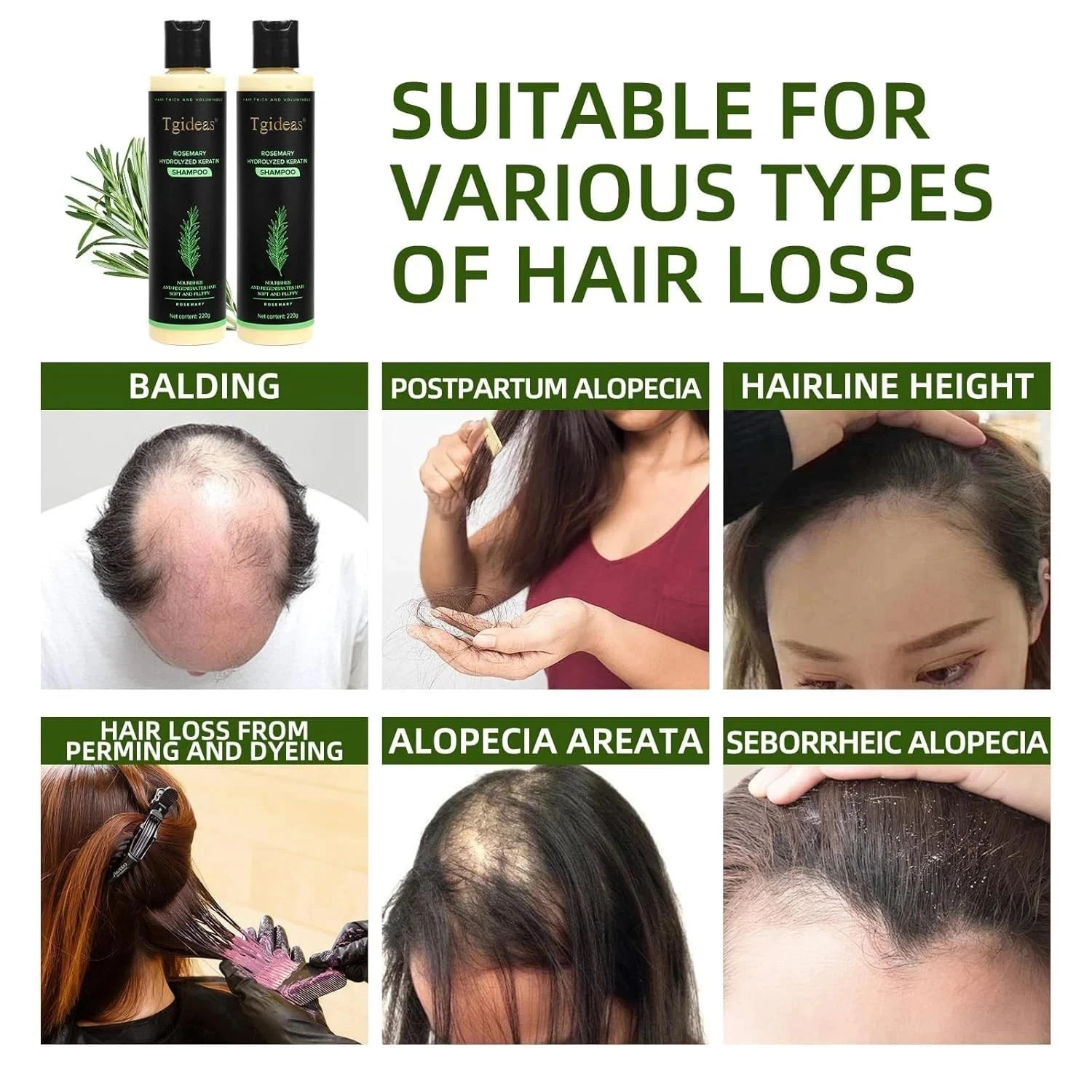 Tgideas System Rosemary Shampoo + pink conditioner to Reduce Hair Loss