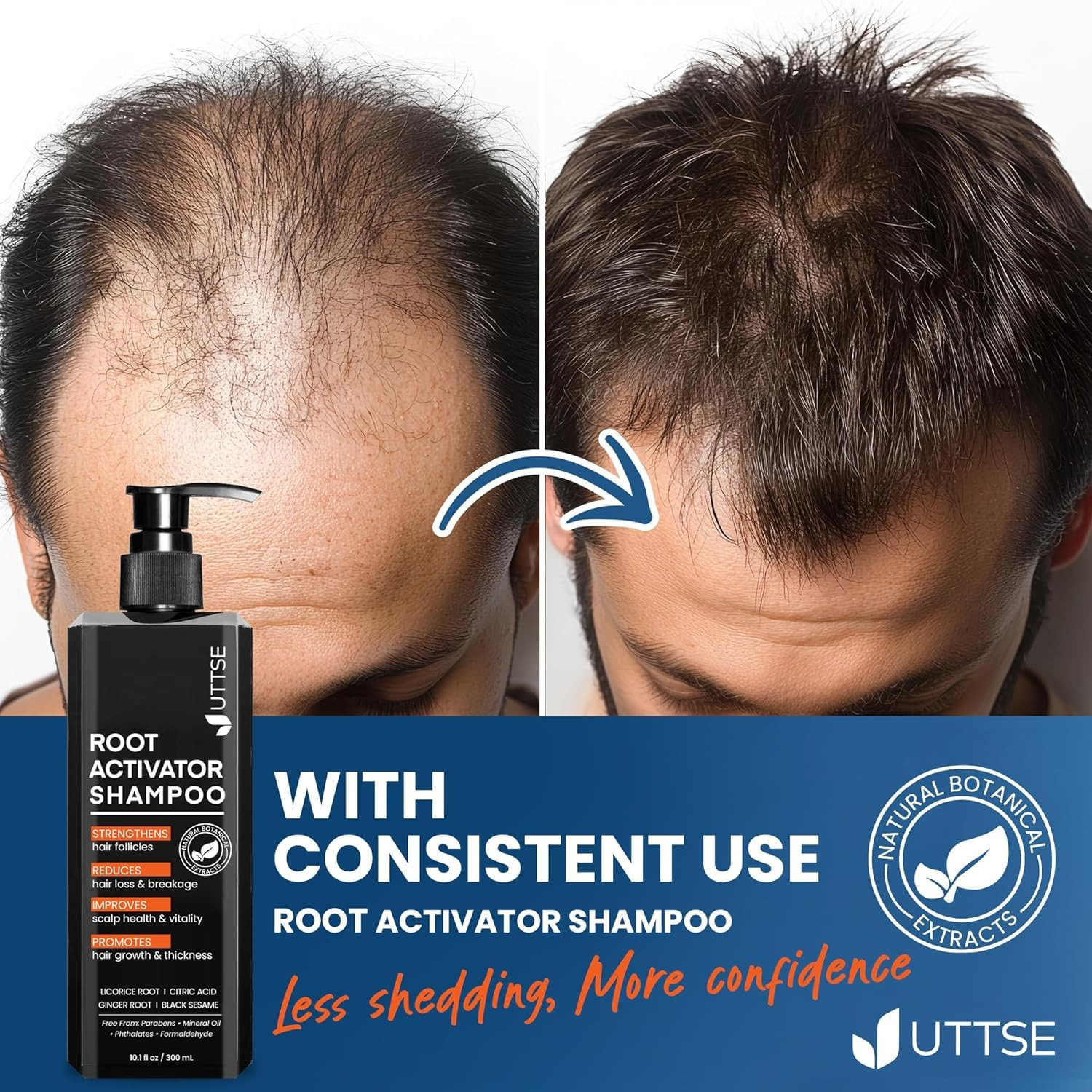 Root Activator Shampoo for Men: Hair Growth Shampoo for Men’S Thinning Hair and