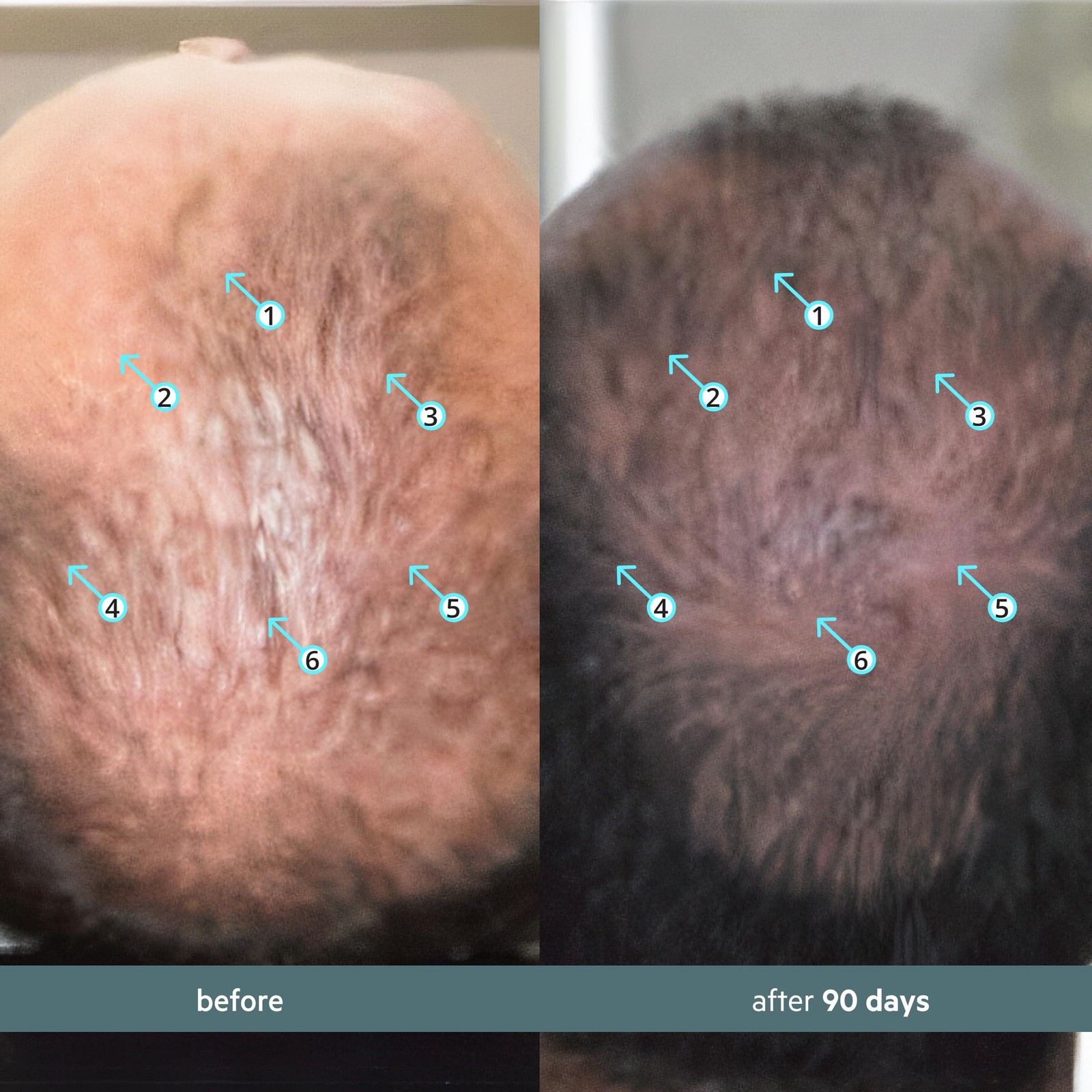DS Labs Spectral Booster (formerly Spectral.F7) Hair Density Serum, 60mL – No…