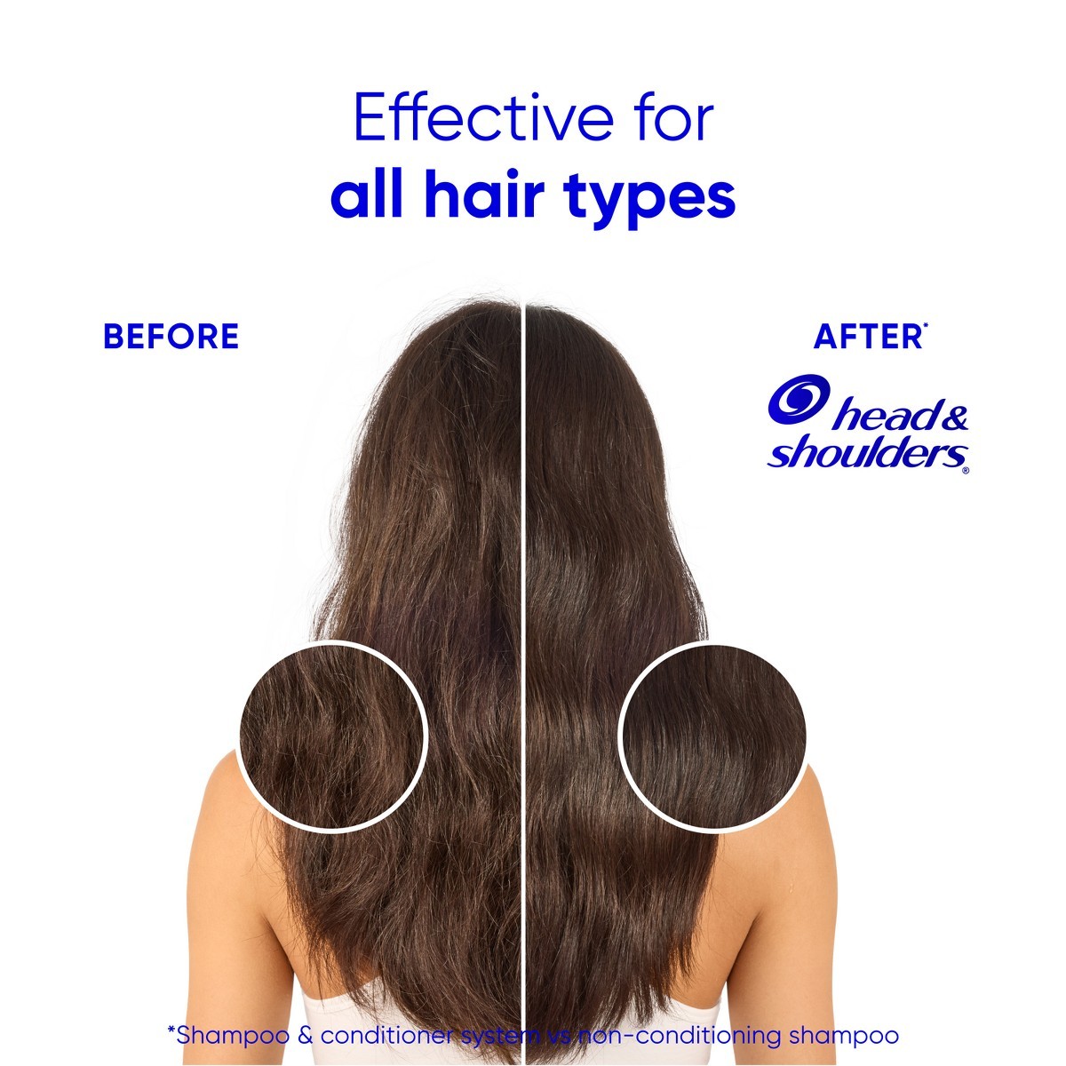 Head & Shoulders 2-in-1 Smooth & Silky Shampoo – 28.2 fl oz: For All Hair Types