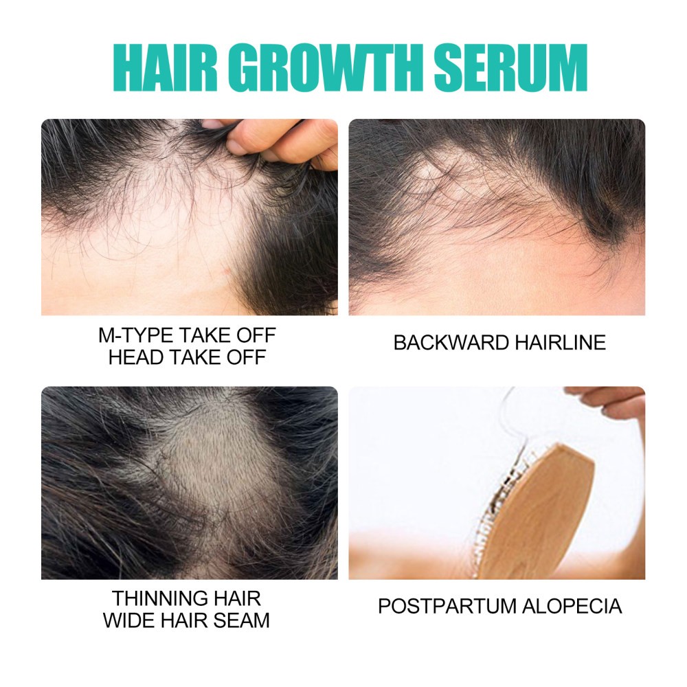Dense Hair ence Repair Moisturizing Dry and Irritable