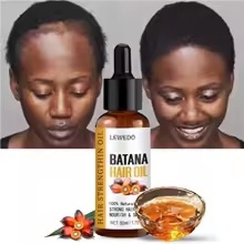Batana Hair Oil 50ml Natural Hair Growth Oil Scalp Treatment for Thicker Hair