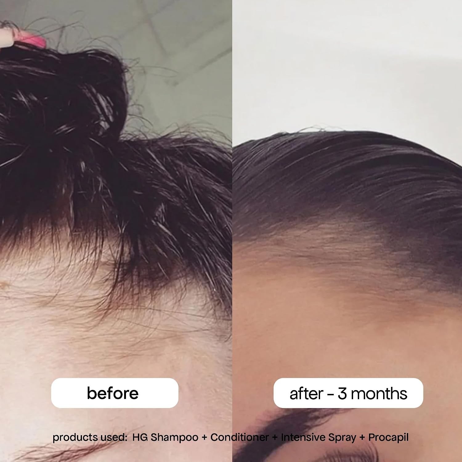 Intensive Thickening Spray [4.23 fl oz], Daily Leave In Hair Treatment to Red…