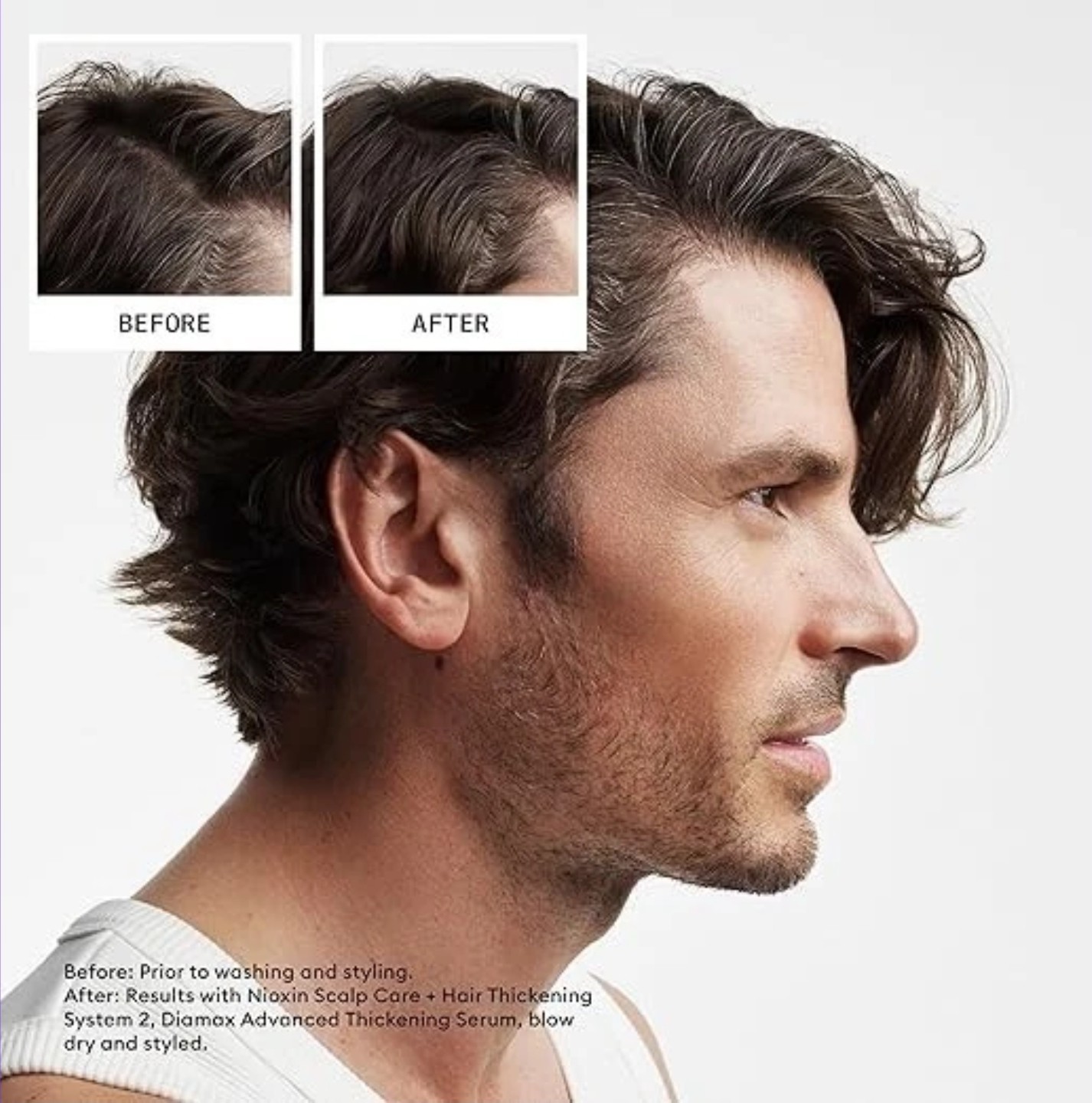 NIOXIN Scalp + Hair Shampoo #2 Natural/Untreated Hair (10.1oz)