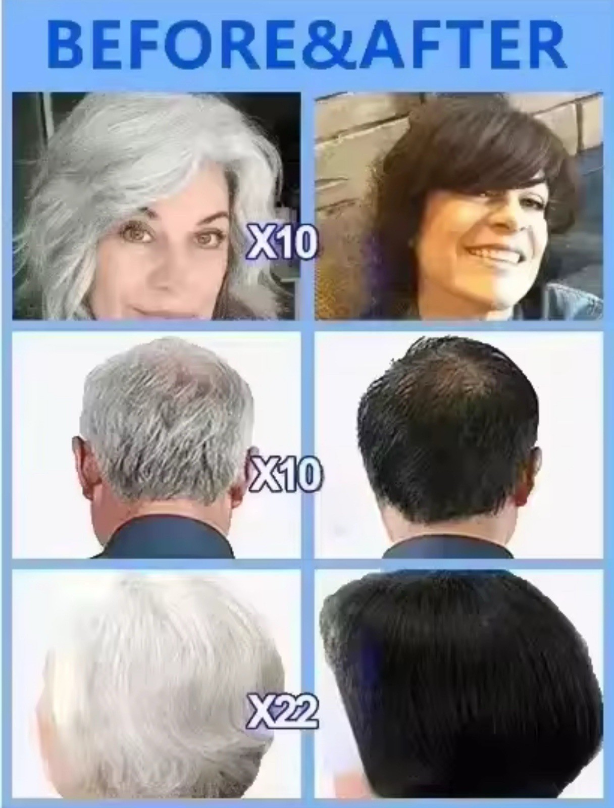 2 Bottles White Hair Killer Remove Gray Hair Restore Natural Hair Color NEW