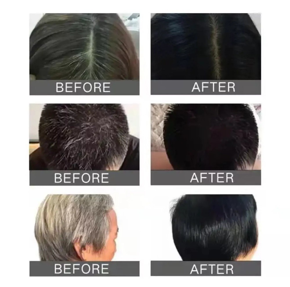 10-100X DEXE Black Hair Shampoo Natural Instant 5-Min Hair Color Dye for Unisex