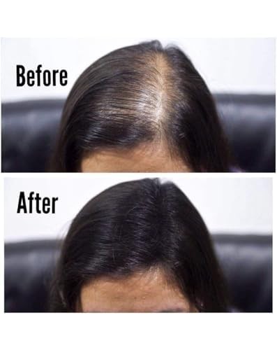 Toppik Hair Building Fiber Natural Black Pack of 2 x 27.7 Gram Free ship