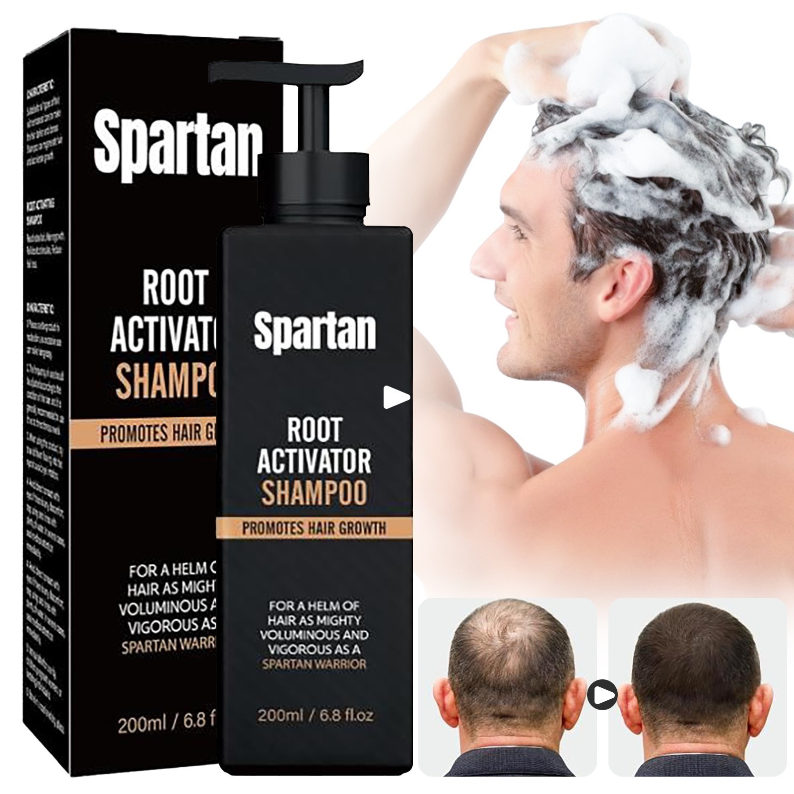 3 pack Root Activator Shampoo SPARTAN Hair Loss Shampoo Root Activator-200ml US