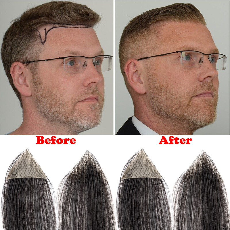 Bald Spot Human Hair Patch Toupee For Men Replacement Unit PU Ultra Thin Skin UK
