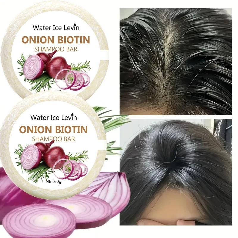 2pcs Onion and Biotin Shampoo Bar Soap, Moisturizing & Soothing