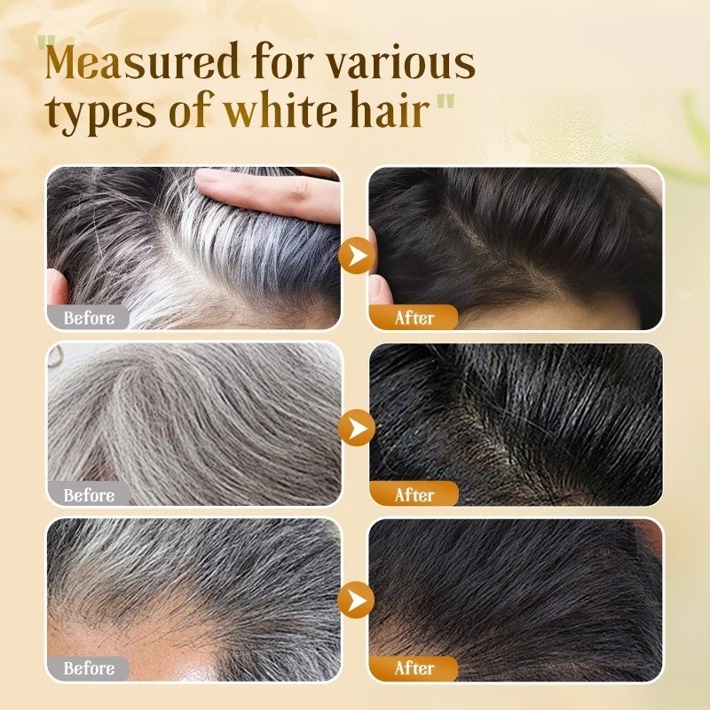 New 3 x 300ml Dr.Ville Black Hair Shampoo Black Nourishing Shampoo Express Ship