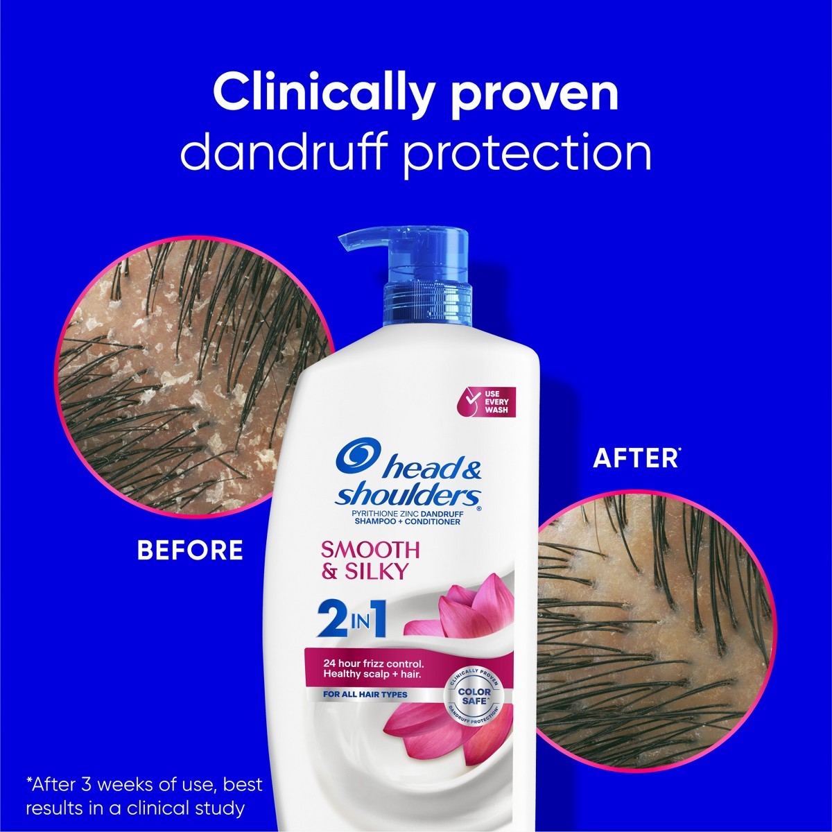 Head & Shoulders 2-in-1 Smooth & Silky Shampoo – 28.2 fl oz: For All Hair Types